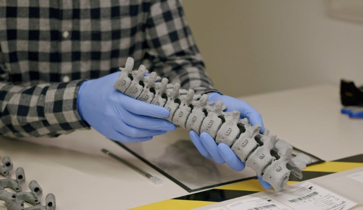 Mighty Oak Medical partners with HP to improve spinal surgeries with 3D printing