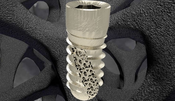 6K Additive partners with Z3DLab to manufacture high-performance titanium powders for 3D printing ap