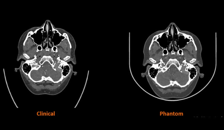 Stratasys partners with Siemens Healthineers in “landmark research project” to advance medical imagi